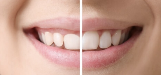 general dentistry  Dayton, TX 